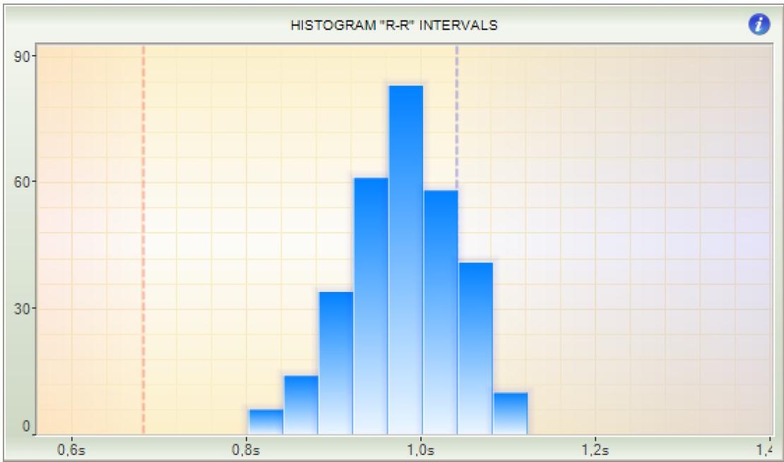 Histogram r-r intervals