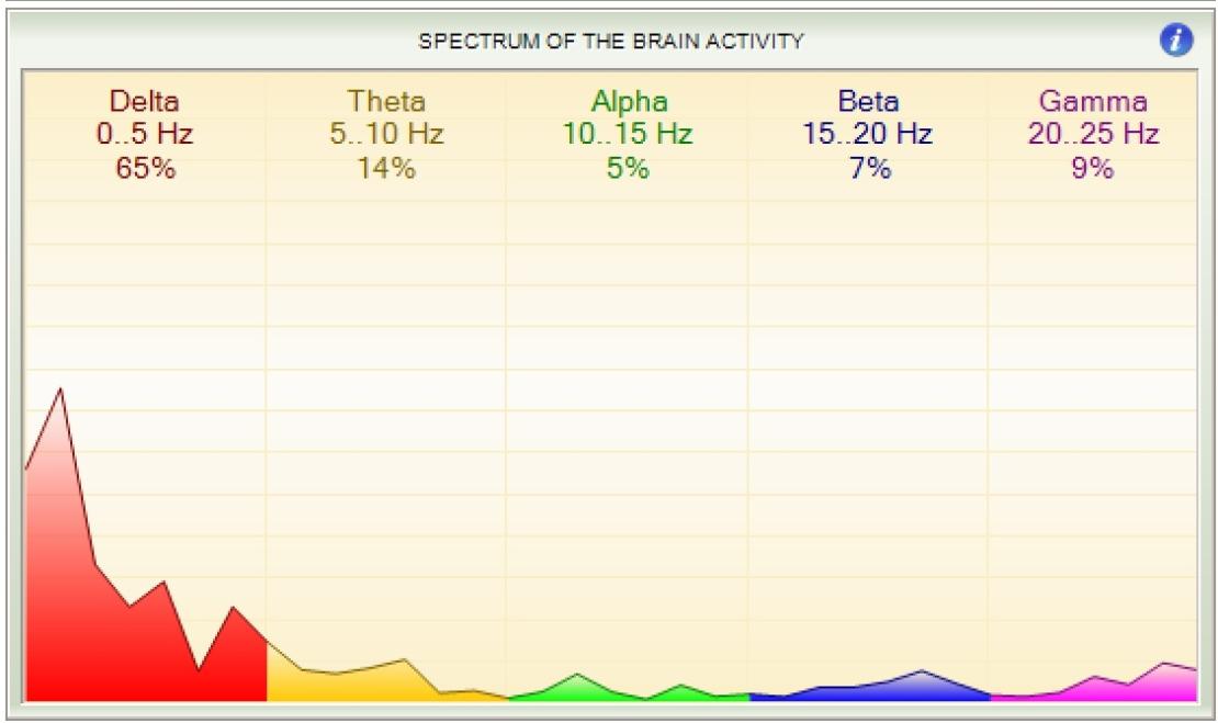 Spectrum of the brain activity