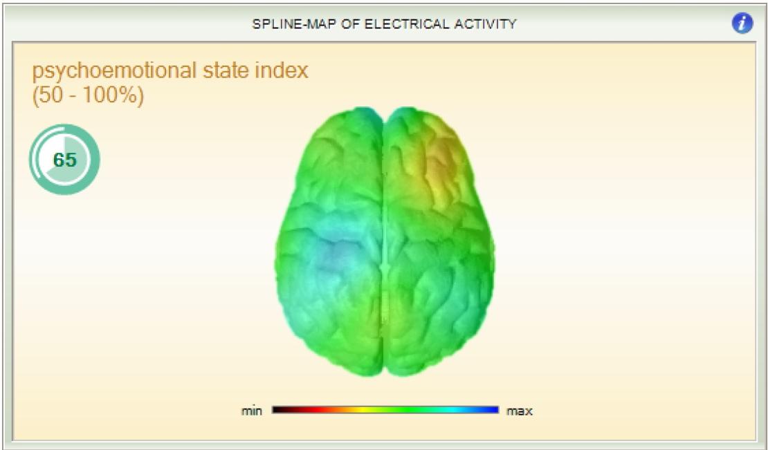 Spline map of electrical activity